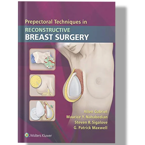 Prepectoral Techniques in Reconstructive Breast Surgery 1st Edition