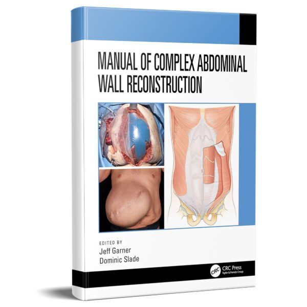 Manual of Complex Abdominal Wall Reconstruction 1st Edition