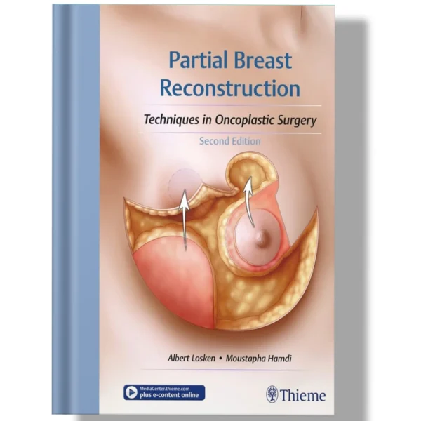 Partial Breast Reconstruction: Techniques in Oncoplastic Surgery