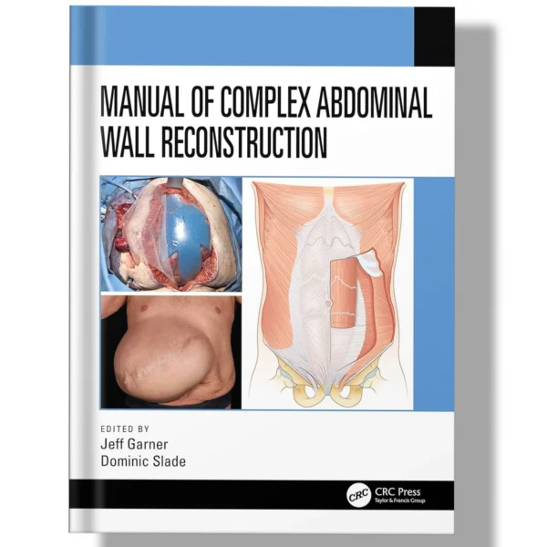 Manual of Complex Abdominal Wall Reconstruction 1st Edition
