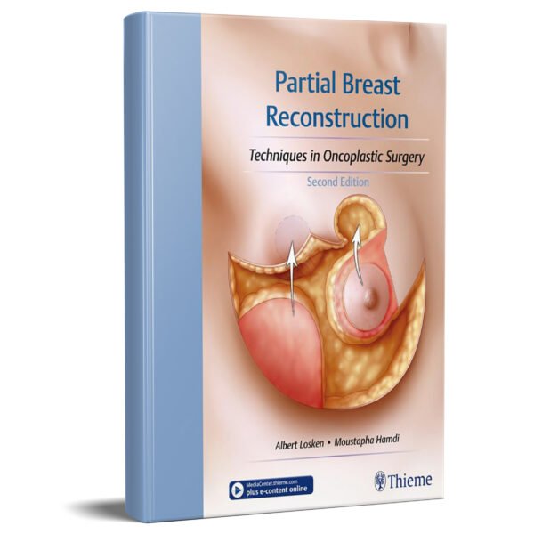 Partial Breast Reconstruction: Techniques in Oncoplastic Surgery