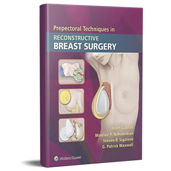 Prepectoral Techniques in Reconstructive Breast Surgery 1st Edition