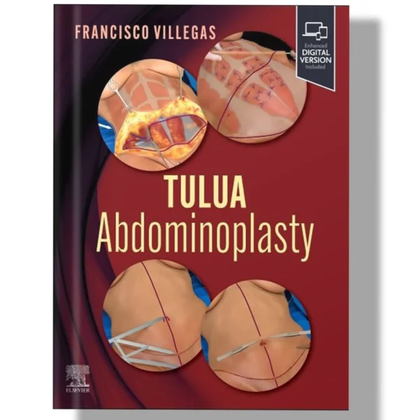 TULUA Abdominoplasty: Transverse Plication Technique 1st Edition