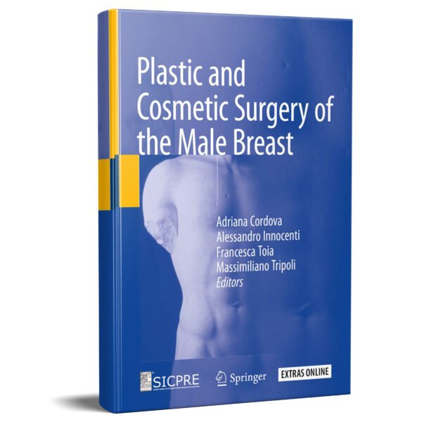 Plastic and Cosmetic Surgery of the Male Breast 1st Edition