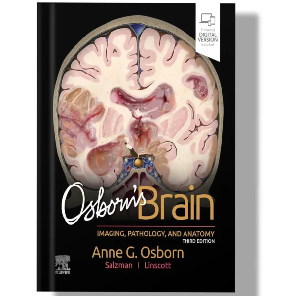 Osborn’s Brain 3rd Edition