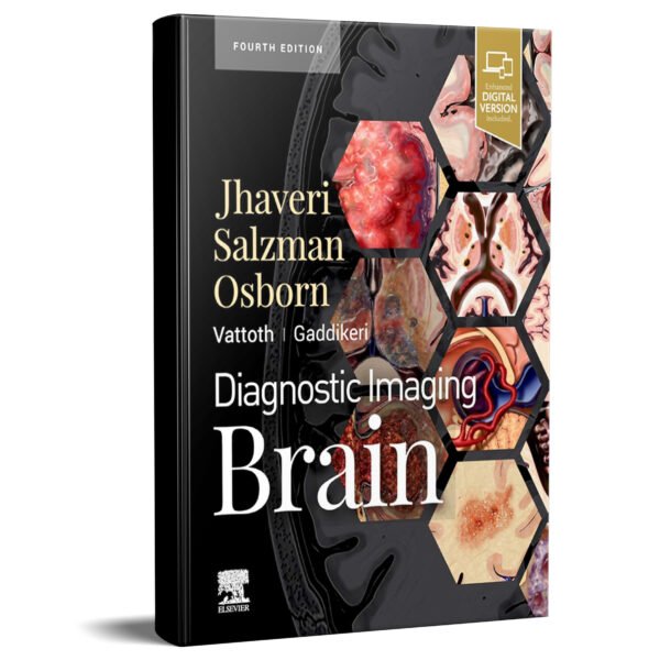 Diagnostic Imaging: Brain 4th Edition