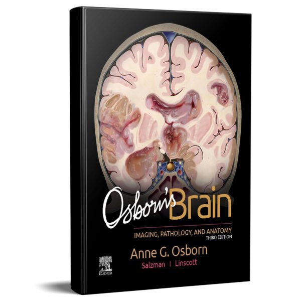 Osborn’s Brain 3rd Edition