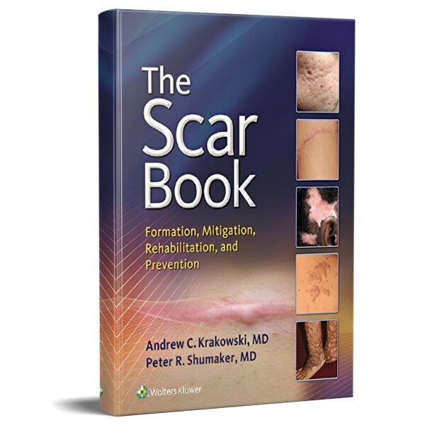 The Scar Book: Formation, Mitigation, Rehabilitation and Prevention 1st Edition