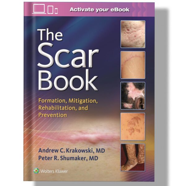 The Scar Book: Formation, Mitigation, Rehabilitation and Prevention 1st Edition