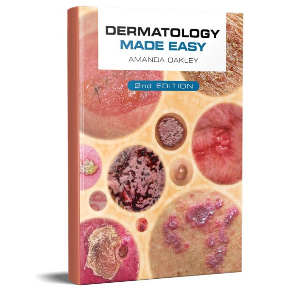 Dermatology Made Easy, second edition