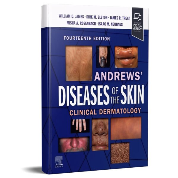 Andrews' Diseases of the Skin: Clinical Dermatology 14th Edition
