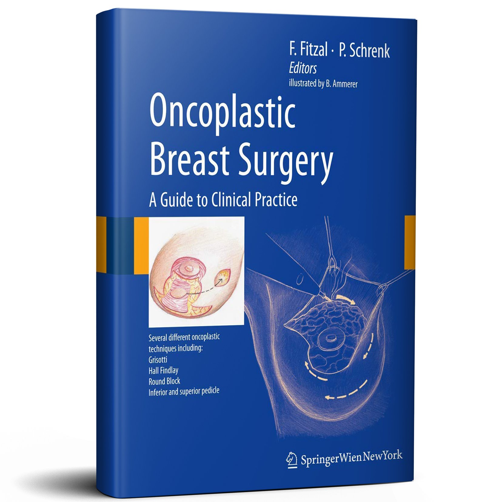 Oncoplastic Breast Surgery: A Guide to Clinical Practice