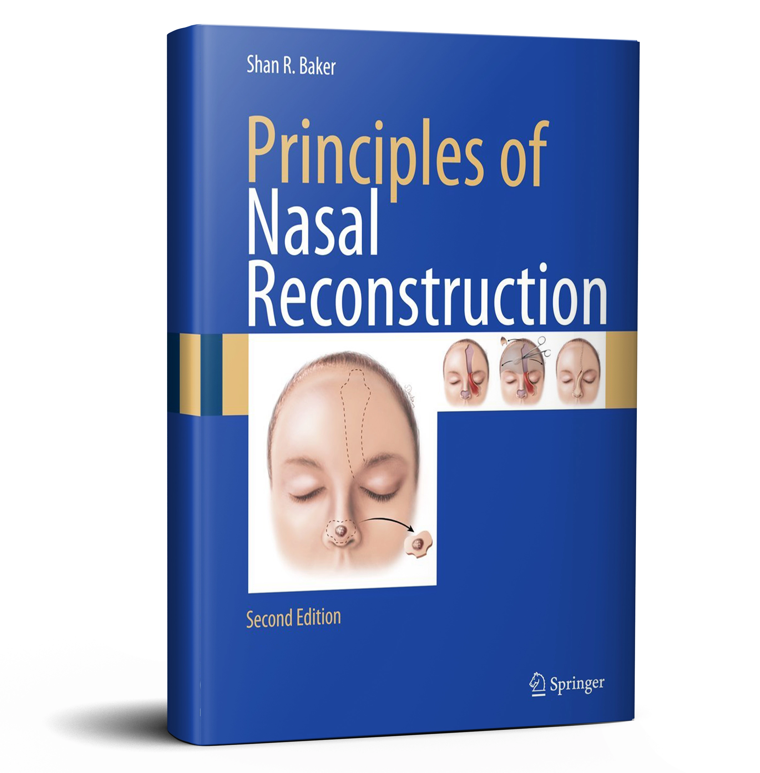 Principles of Nasal Reconstruction
