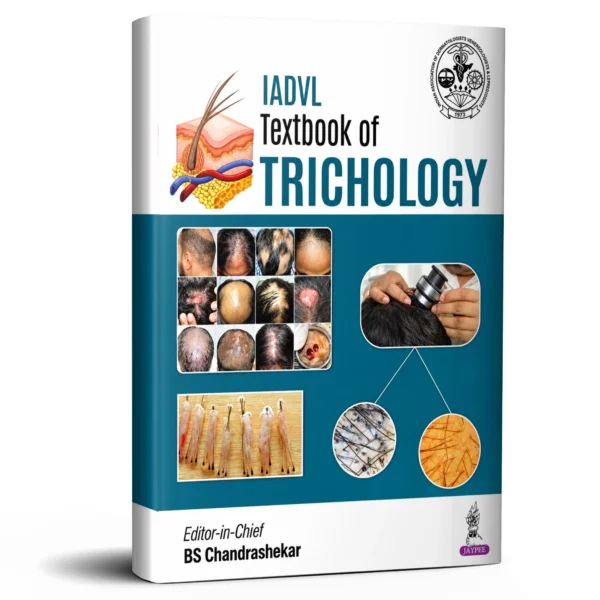 IADVL Textbook of Trichology