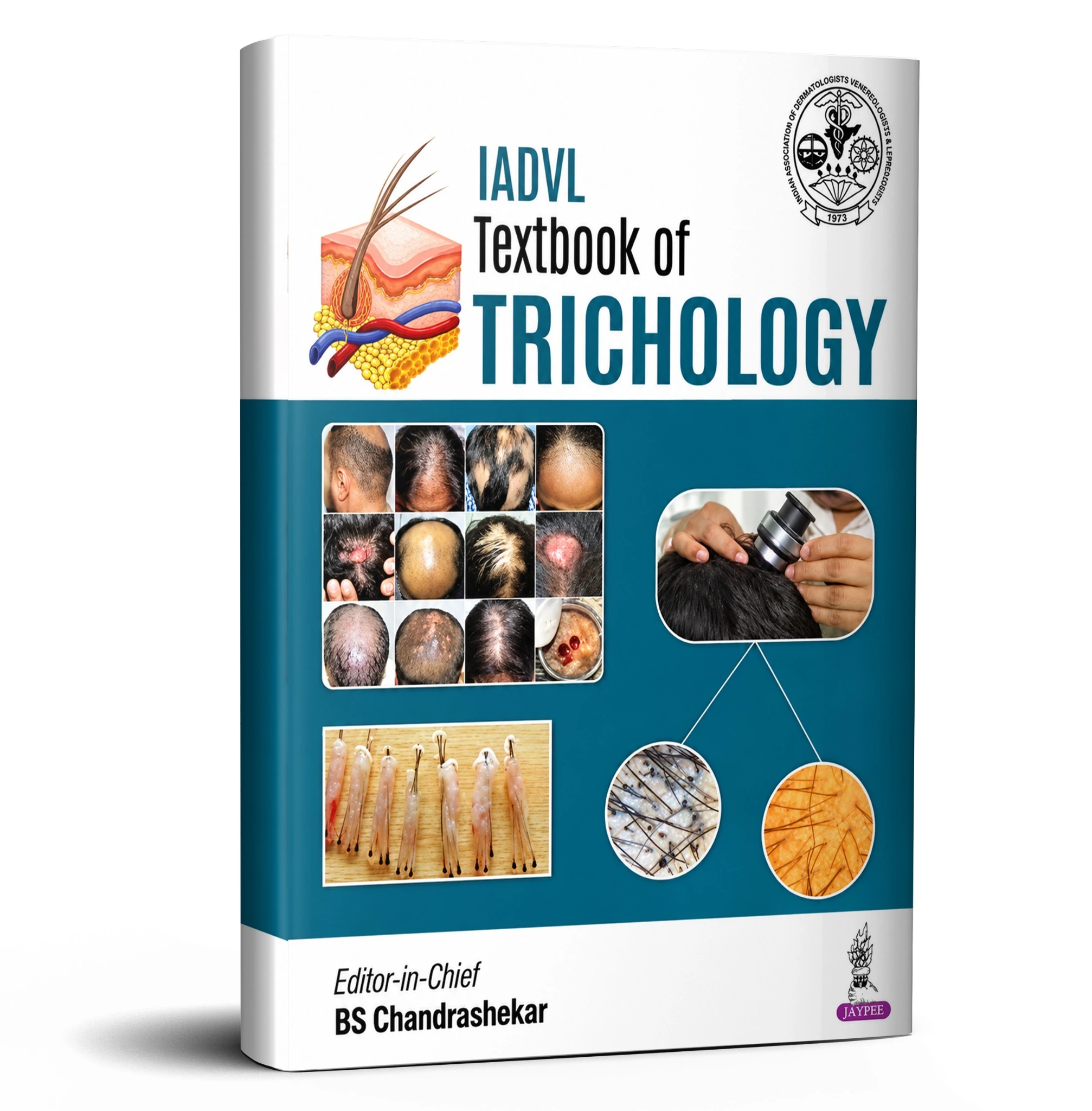IADVL Textbook of Trichology